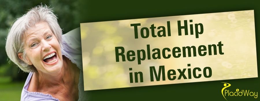 Total Hip Replacement in Mexico Patient Testimonial